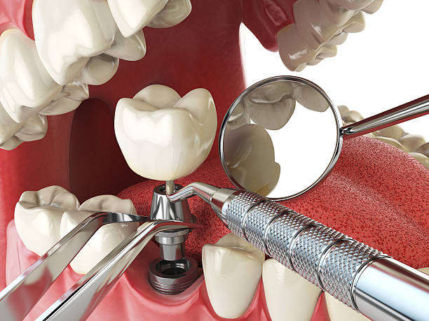 Best Weekend Emergency Dentist in Plattsburg, MO